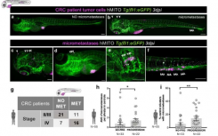 临床研究表明癌症患者的斑马鱼化身具有很高的预测能力