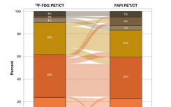 比较分析显示 FAPI PET/CT 可改善新诊断乳腺癌的分期