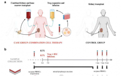 肾移植：联合细胞疗法被发现可降低供体特异性免疫反应