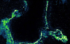 化学家开发出一种追踪 RNA 关键编辑的测试方法