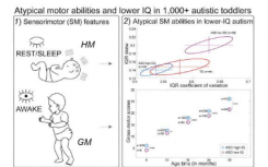 新研究确定了自闭症谱系障碍的早期感觉运动标记
